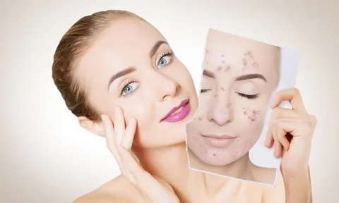 Muôn vàn lợi ích tuyệt vời của nước muối đối với làn da và mái tóc mà bạn nên biết