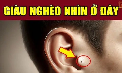 5 nốt ruồi giàu sang, ai sở hữu 1 cũng đủ phát tài may mắn hơn người