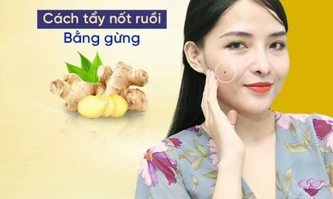 Tự tẩy nốt ruồi bằng gừng cực nhanh, an toàn và không để lại sẹo