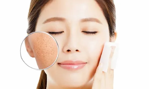 Điểm danh những sự thật quan trọng về lỗ chân lông mà bạn nên biết