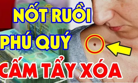 4 nốt ruồi phú quý nhiều người "muốn có cũng không được", có 1/4 chẳng lo thiếu tiền