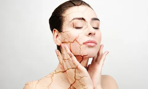 Bỏ túi loạt mẹo giảm tình trạng da khô xỉn màu lão hóa nhanh