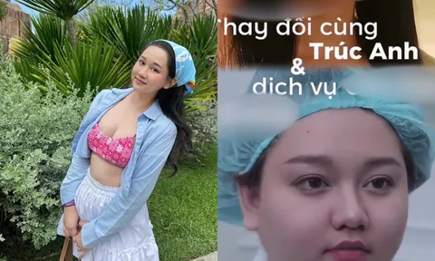 Nghi vấn Trúc Anh (Mắt Biếc) phẫu thuật thẩm mỹ?