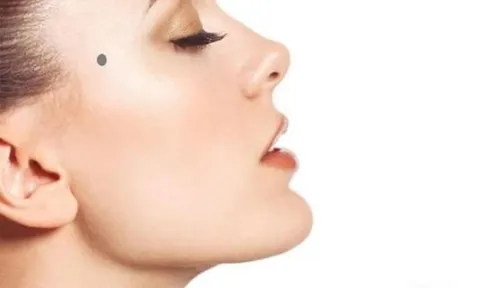 3 vị trí nốt ruồi điềm báo xui xẻo, dấu hiệu của trắc trở đường đời