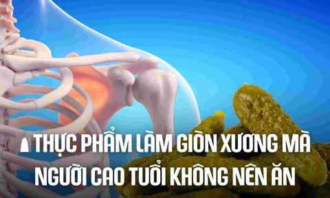 3 loại nước là 'vua rút cạn canxi, uống nhiều xương giòn, dễ gãy