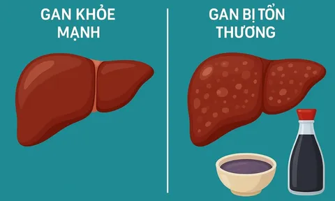 Cảnh báo: Loại gia vị quen thuộc này có thể âm thầm hại gan mà nhiều người Việt chưa biết