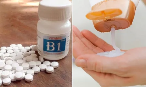 Trộn dầu gội với vitamin B1, có ngay hỗn hợp đặc biệt với công dụng tuyệt vời