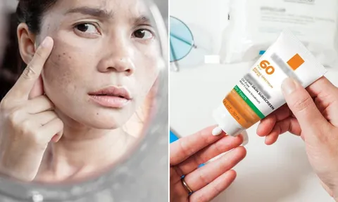 Sai lầm khi thoa kem chống nắng làm da sạm nám nhiều hơn