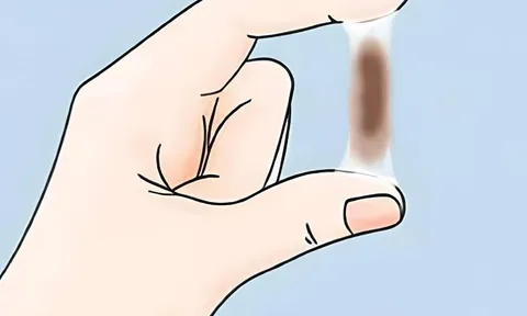 Chảy máu sau quan hệ – Cảnh báo ung thư cổ tử cung nhiều người chủ quan bỏ qua