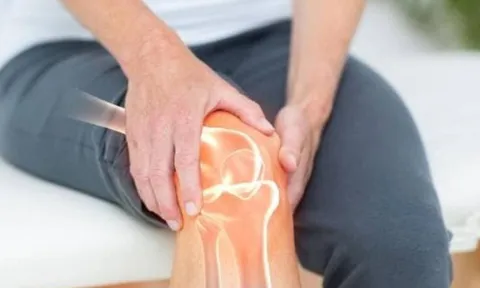 3 loại nước bị ví như 'vua rút cạn canxi' – Uống thường xuyên khiến xương giòn yếu