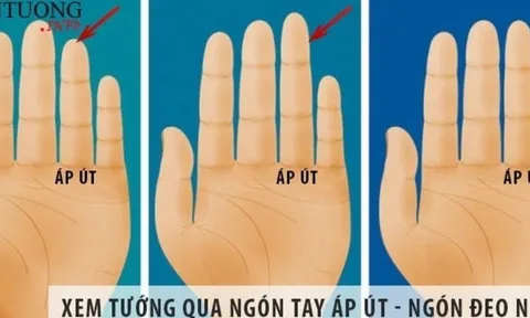 Ngón áp út có 1 trong 5 dấu hiệu này, ai sở hữu cũng dễ thành công, giàu sang bền vững