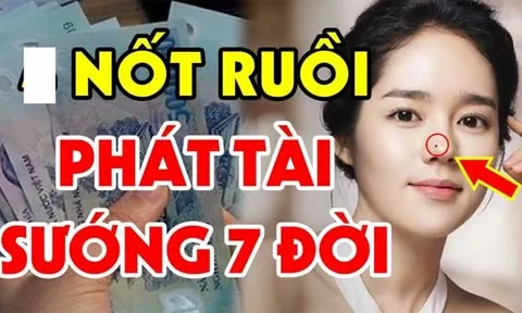 3 nốt ruồi Phá Tướng, Hao Tài : Ai có nên xóa ngay trước khi quá muộn, kiểm tra ngay xem bạn có không?