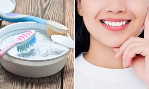 4 cách làm trăng răng tại nhà không gây ê buốt, mòn men răng