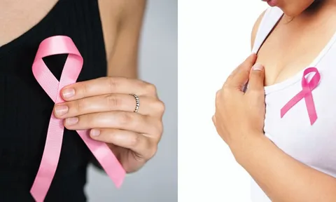 12 nhóm phụ nữ có nguy cơ Ung Thư Vú cao, chú ý xem bạn thuộc nhóm này không