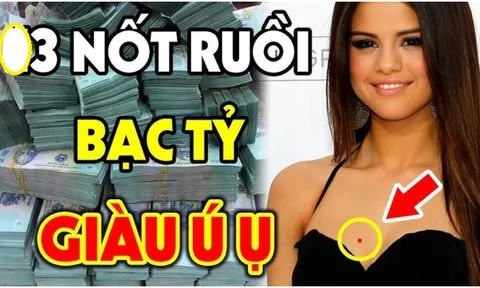 3 nốt ruồi là Hố Chôn Tiền: Ai có được hút bạc tỷ, đừng dại xóa đi