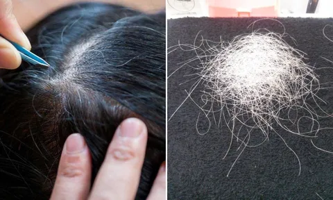 Thường xuyên nhổ tóc bạc, tóc sâu gây ra 4 tác hại này