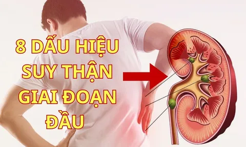 8 Dấu Hiệu Suy Thận Giai Đoạn Đầu: Phát hiện sớm cứu cả cuộc đời