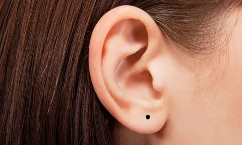 Người phụ nữ có 4 nốt ruồi ở những vị trí này, nhất định sẽ giàu có sau tuổi 30