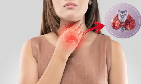 Ung thư tuyến giáp là mối đe dọa âm thầm: 6 có nhóm người dễ mắc bệnh này, nhất định phải thận trọng