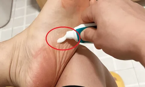Bôi kem đánh răng vào lòng bàn chân trước khi ngủ, việc nhỏ mà lợi ích to