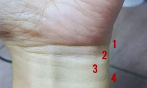 Nhìn vào 4 ngấn cổ tay: Biết ngay cuộc đời sung sướng Tiền Nhiều hay Nghèo Khổ