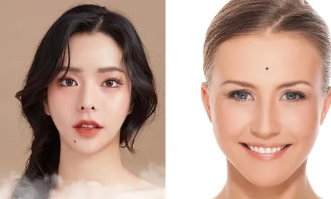 Người sở hữu 1 trong 3 nốt ruồi này đều mang phú quý, về giàu tiền đầy két, giàu 3 đời