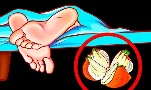 Đi ngủ đặt 1 củ hành tây ở đầu giường: Mẹo hay 10 nhà thì 9 nhà không biết cực kỳ cần thiết