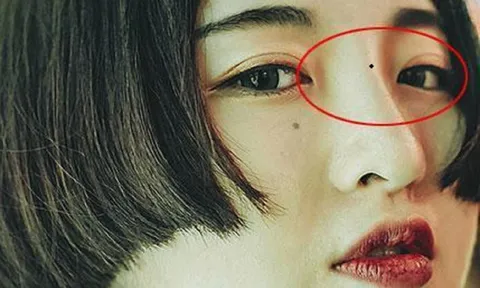 4 nốt ruồi hao tài: Ai có dù tài ba tới mấy cũng khó thoát nghèo