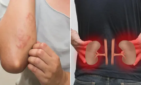 Cơ thể có 7 dấu hiệu này, cảnh báo bệnh thận, suy thận đang đến gần