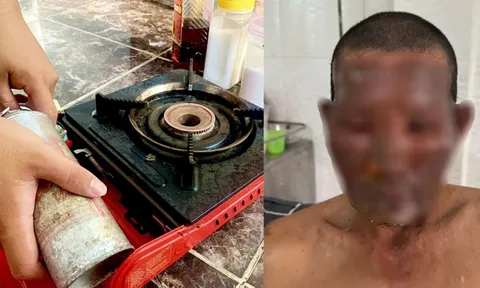 Bình gas mini phát nổ, 8 người nhập viện, lưu ý cách dùng để tránh họa bình gas mini