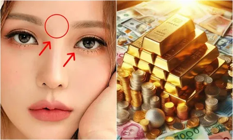 Người có 3 điểm này trên mặt Điềm Báo Phát Tài: Tiền vào như nước, thăng quan giàu có