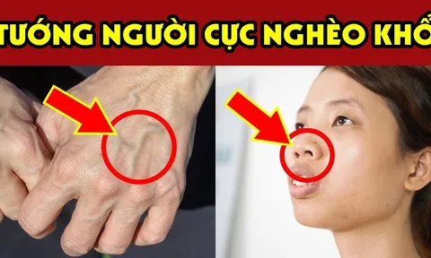 Người có 3 nét tướng này càng sống càng Bạc Phúc: Trẻ thì ốm đau hao tài, già thì cô độc nghèo khổ