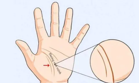 Giải mã 3 đường chỉ tay liên quan đến vận mệnh mỗi người