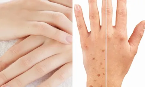 Mu bàn tay tiết lộ bí mật sống thọ: 4 dấu hiệu ai cũng nên kiểm tra