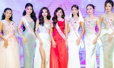 Hoa hậu Bông Sen Việt 2025 cho phép thí sinh thẩm mỹ trong mức độ cho phép, hỗ trợ thí sinh vùng sâu vùng xa