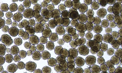 Tin vui: Người bị tiểu đường có hy vọng phục hồi khả năng sản xuất insulin