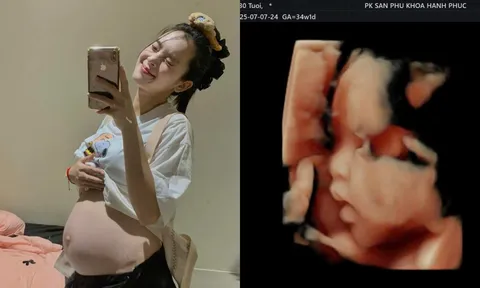 Diễn viên Quỳnh Lương kiệt sức ở tháng thứ 8 thai kỳ lần 2: Đau đớn toàn thân, khó khăn di chuyển