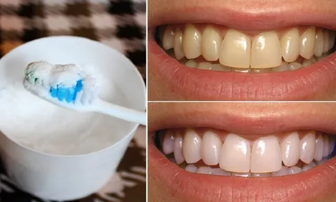 Đánh răng bằng thứ này, làm sạch mảng bám, tẩy trắng răng, không mòn men răng