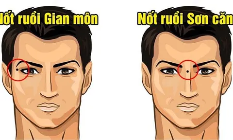 4 nốt ruồi phá hủy Phúc Lộc: Ai có tuổi trẻ gian nan, cuối đời túng thiếu cô độc