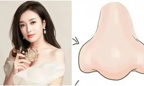90% người giàu có sở hữu tướng mũi này: Không chỉ đẹp mà còn vượng