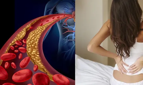 Người gầy vẫn bị mỡ máu cao vì những lý do này