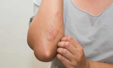 4 dấu hiệu cảnh báo thận của bạn đang kêu cứu: Có 1 cũng nên đi khám sớm