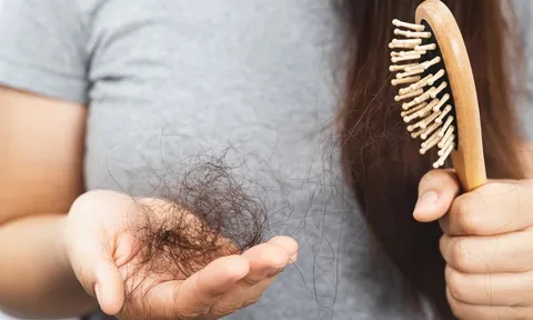 Càng ăn 5 loại thực phẩm này, tóc càng rụng nhiều: Món số 1 được nhiều người yêu thích
