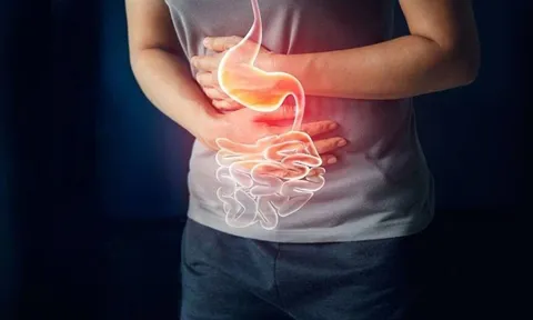 Ung thư dạ dày gia tăng nhanh chóng: 4 thói quen hàng ngày là "thủ phạm giấu mặt"