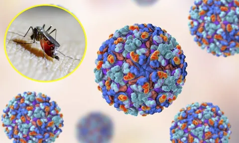 WHO cảnh báo nguy cơ bùng phát dịch do một loại virus nguy hiểm, 5,6 tỷ người có khả năng mắc bệnh