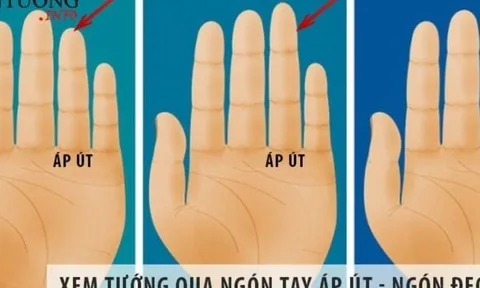 Ngón áp út có 1 trong 5 dấu hiệu này, ai cũng mang mệnh giàu sang phú quý, tiền bạc rủng rỉnh