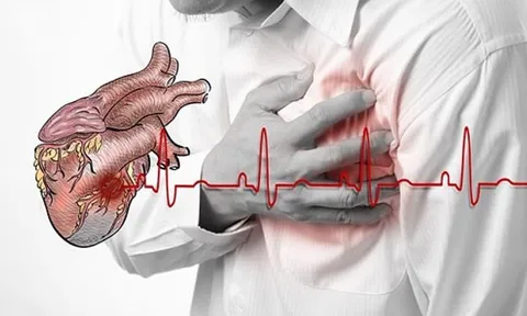 Ông Hoàng Nam Tiến đột ngột qua đời: Cảnh báo biến cố tim đe doạ cả người khoẻ mạnh