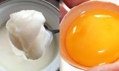 5 món ngon từng bị hiểu lầm là có hại, hóa ra lại siêu tốt cho sức khỏe: Đừng dại mà bỏ đi