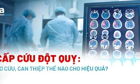 Cách sơ cứu đột quỵ tại nhà đúng cách nhất