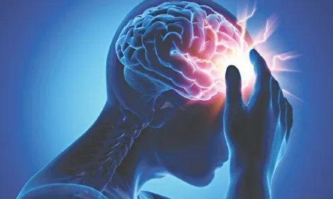 Ông Hoàng Nam Tiến qua đời vì đột quỵ: Dấu hiệu nhận biết đột quỵ trước 1 tuần là gì?